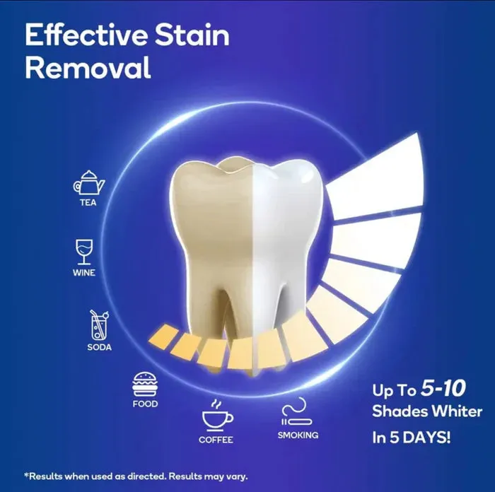 MySmile® V34 Teeth Brightening Bundle