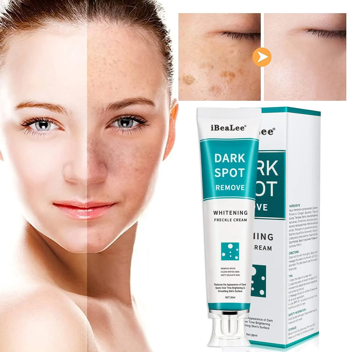 Whitening Freckle Cream Face Moisturizing Remove Dark/moisturizing/cerave moisturizing cream/clinique moisture surge/body lotion/